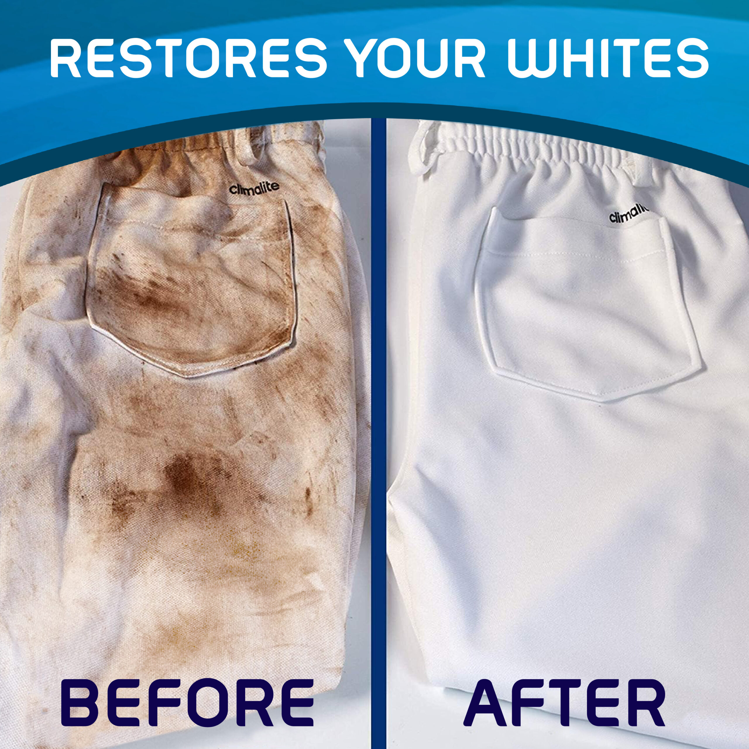 How To Whiten White Clothes